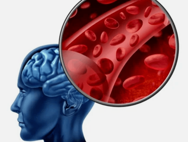 Kakla osteohondroze