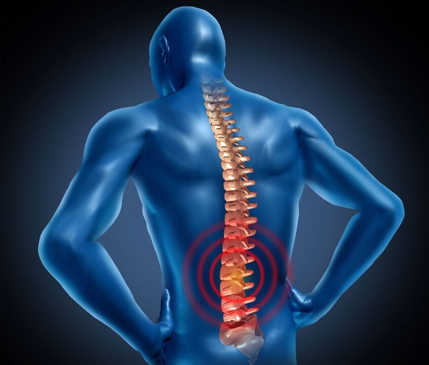 Jostas osteohondroze