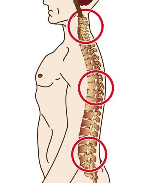 mugurkaula departamenti, kuros notiek osteohondroze