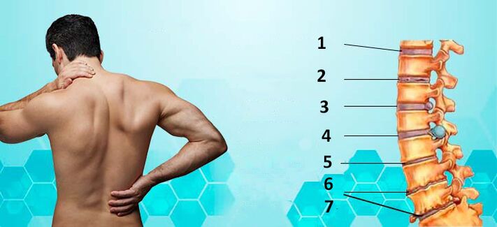 Osteohondrozes attīstības stadijas